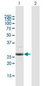 Anti-PSMB4 antibody produced in rabbit purified immunoglobulin, buffered aqueous solution