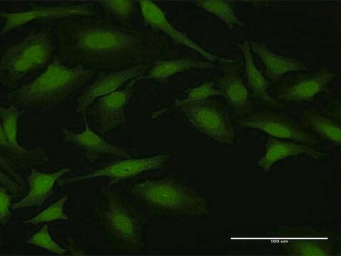 Anti-NUDT5 antibody produced in rabbit purified immunoglobulin, buffered aqueous solution