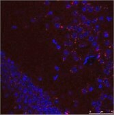 Anti-HSPA8 affinity isolated antibody