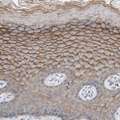 Anti-ORAI1 antibody produced in rabbit Prestige Antibodies&#174; Powered by Atlas Antibodies, affinity isolated antibody, buffered aqueous glycerol solution