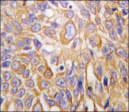 Anti-DDIT4 (N-term) antibody produced in rabbit IgG fraction of antiserum, buffered aqueous solution