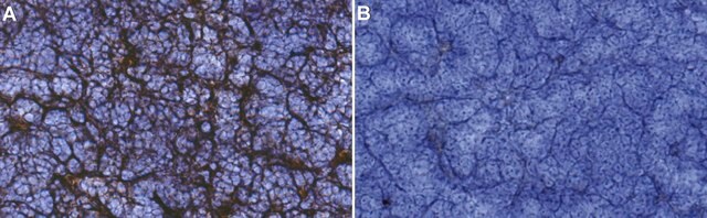 Anti-Cortical stromal cells Antibody, clone ER-TR4