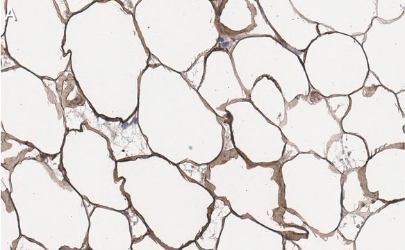 Anti-FASN Antibody, clone 2C13 ZooMAb&#174; Rabbit Monoclonal recombinant, expressed in HEK 293 cells