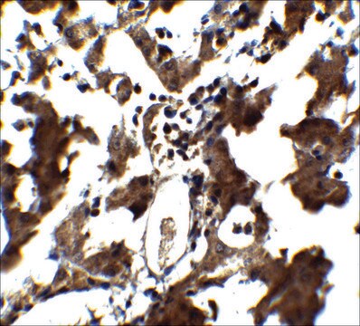 Anti-ZEB1 antibody produced in rabbit affinity isolated antibody, buffered aqueous solution