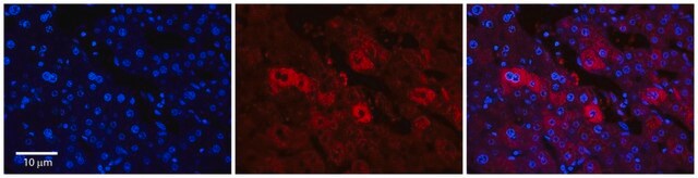 Anti-EEA1 antibody produced in rabbit affinity isolated antibody