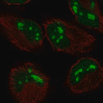 Anti-Zcchc2 Antibody Produced In Rabbit Prestige Antibodies&#174; Powered by Atlas Antibodies, affinity isolated antibody, buffered aqueous glycerol solution