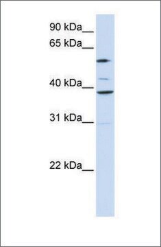 Anti-SLC25A16 antibody produced in rabbit affinity isolated antibody