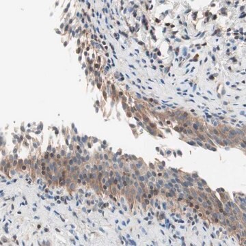 Anti-RAD54B antibody produced in rabbit Prestige Antibodies&#174; Powered by Atlas Antibodies, affinity isolated antibody, buffered aqueous glycerol solution