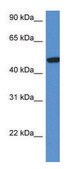 Anti-HEXA (C-terminal) antibody produced in rabbit affinity isolated antibody