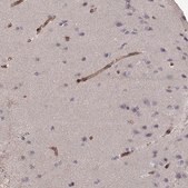 Anti-LAMB2 antibody produced in rabbit Prestige Antibodies&#174; Powered by Atlas Antibodies, affinity isolated antibody, buffered aqueous glycerol solution