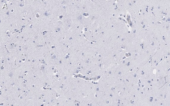 Anti-Neurofilament H Antibody, clone 5L10, ZooMAb&#174; Rabbit Monoclonal recombinant, expressed in HEK 293 cells