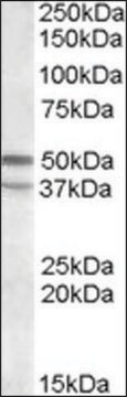 Anti-HTR7 (C-terminal) antibody produced in goat affinity isolated antibody, buffered aqueous solution