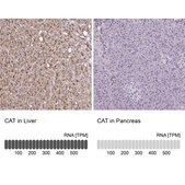 Anti-CAT antibody produced in rabbit Prestige Antibodies&#174; Powered by Atlas Antibodies, affinity isolated antibody, buffered aqueous glycerol solution