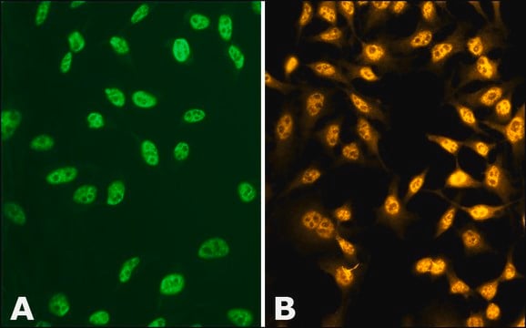 Anti-phospho-TDP-43 (pSer410) antibody produced in rabbit ~1.0&#160;mg/mL, affinity isolated antibody