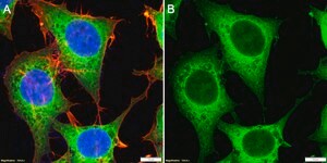 Anti-GSPT1 Antibody, clone 1F21 ZooMAb&#174; Rabbit Monoclonal recombinant, expressed in HEK 293 cells