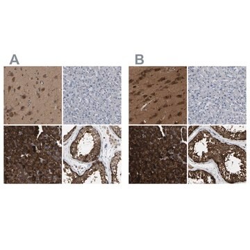 Anti-GARS antibody produced in rabbit Prestige Antibodies&#174; Powered by Atlas Antibodies, affinity isolated antibody, buffered aqueous glycerol solution