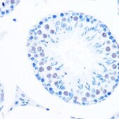 Anti-DNA Polymerase beta antibody produced in rabbit