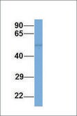 Anti-PPARA, (N-terminal) antibody produced in rabbit affinity isolated antibody