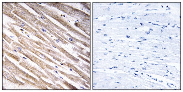 Anti-RPL3L antibody produced in rabbit affinity isolated antibody