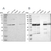 Anti-UQCRC2 antibody produced in rabbit Prestige Antibodies&#174; Powered by Atlas Antibodies, affinity isolated antibody, buffered aqueous glycerol solution