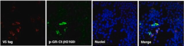 Anti-C9ORF72 (&#945;-GR sense Antibody, CT) serum, from rabbit