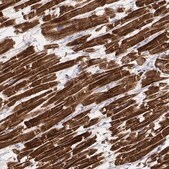 Monoclonal Anti-MYH6 antibody produced in mouse Prestige Antibodies&#174; Powered by Atlas Antibodies, clone CL2155, purified immunoglobulin, buffered aqueous glycerol solution