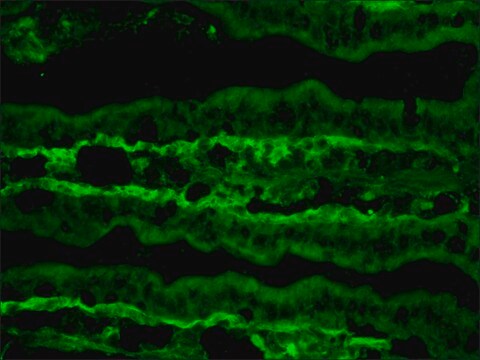 Monoclonal Anti-Tenascin antibody produced in rat clone MTn-12, ascites fluid