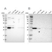 Anti-CASP6 antibody produced in rabbit Prestige Antibodies&#174; Powered by Atlas Antibodies, affinity isolated antibody, buffered aqueous glycerol solution