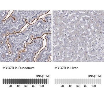 Anti-MYO7B antibody produced in rabbit Prestige Antibodies&#174; Powered by Atlas Antibodies, affinity isolated antibody, buffered aqueous glycerol solution