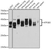Anti-ATP1B3 antibody produced in rabbit
