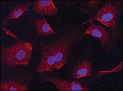 Anti-RanGAP1 (C-terminal) antibody produced in rabbit ~1&#160;mg/mL, affinity isolated antibody, buffered aqueous solution