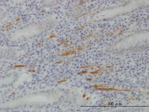 Monoclonal Anti-SMURF1 antibody produced in mouse clone 1D7, purified immunoglobulin, buffered aqueous solution