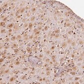 Anti-IGFBP1 antibody produced in rabbit Prestige Antibodies&#174; Powered by Atlas Antibodies, affinity isolated antibody, buffered aqueous glycerol solution