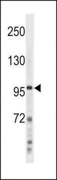 ANTI-NFKB(P100) (C-TERM S866/870) antibody produced in rabbit affinity isolated antibody, buffered aqueous solution