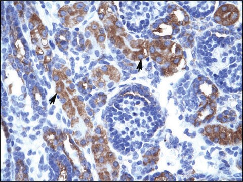 Anti-CHEK1 antibody produced in rabbit affinity isolated antibody