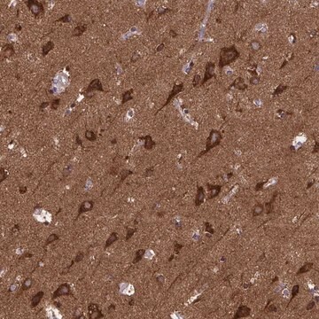 Anti-MCCC1 antibody produced in rabbit Prestige Antibodies&#174; Powered by Atlas Antibodies, affinity isolated antibody, buffered aqueous glycerol solution