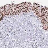 Anti-FOXA1 antibody produced in rabbit Prestige Antibodies&#174; Powered by Atlas Antibodies, affinity isolated antibody, buffered aqueous glycerol solution