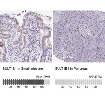 Anti-SULT1B1 antibody produced in rabbit Prestige Antibodies&#174; Powered by Atlas Antibodies, affinity isolated antibody, buffered aqueous glycerol solution