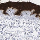Anti-KRT1 antibody produced in rabbit Prestige Antibodies&#174; Powered by Atlas Antibodies, affinity isolated antibody, buffered aqueous glycerol solution