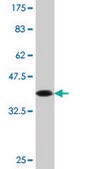 Monoclonal Anti-CASP10, (N-terminal) antibody produced in mouse clone 2E7, purified immunoglobulin, buffered aqueous solution