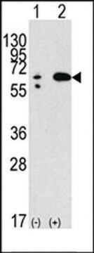 ANTI-BECLIN 1 antibody produced in rabbit IgG fraction of antiserum, buffered aqueous solution