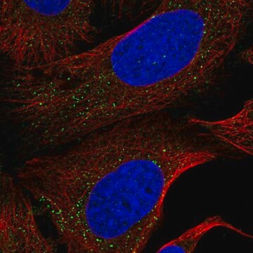 Anti-NEK4 antibody produced in rabbit Prestige Antibodies&#174; Powered by Atlas Antibodies, affinity isolated antibody