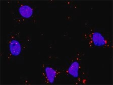 Monoclonal Anti-HDAC1 antibody produced in mouse clone 5C11, purified immunoglobulin, buffered aqueous solution
