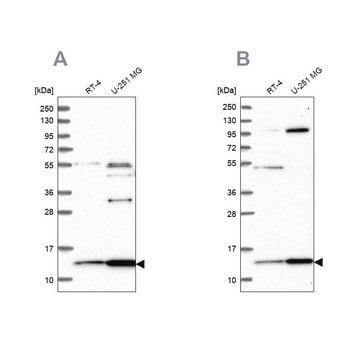 Anti-TRMT112 antibody produced in rabbit Prestige Antibodies&#174; Powered by Atlas Antibodies, affinity isolated antibody, buffered aqueous glycerol solution