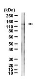 Anti-EphA2 Antibody, clone F2-27 ZooMAb&#174; Mouse Monoclonal recombinant, expressed in HEK 293 cells