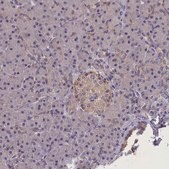 Anti-ABCC8 antibody produced in rabbit Prestige Antibodies&#174; Powered by Atlas Antibodies, affinity isolated antibody, buffered aqueous glycerol solution