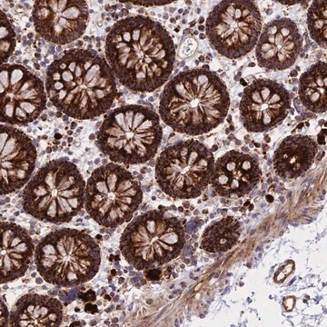 Anti-UQCRB antibody produced in rabbit Prestige Antibodies&#174; Powered by Atlas Antibodies, affinity isolated antibody, buffered aqueous glycerol solution