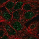 Anti-CA12 antibody produced in rabbit Prestige Antibodies&#174; Powered by Atlas Antibodies, affinity isolated antibody, buffered aqueous glycerol solution