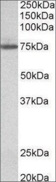 Anti-TGM4 antibody produced in goat affinity isolated antibody, buffered aqueous solution