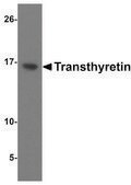 Anti-Transthyretin antibody produced in chicken affinity isolated antibody, buffered aqueous solution